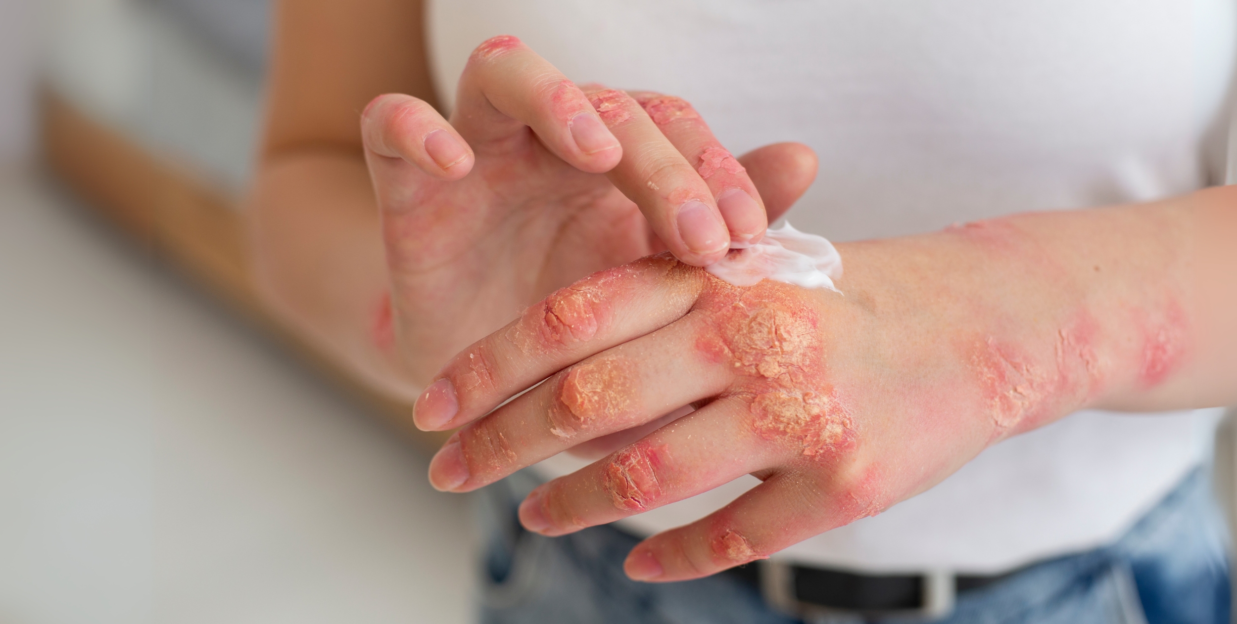 Desi Arthritis Website (1)