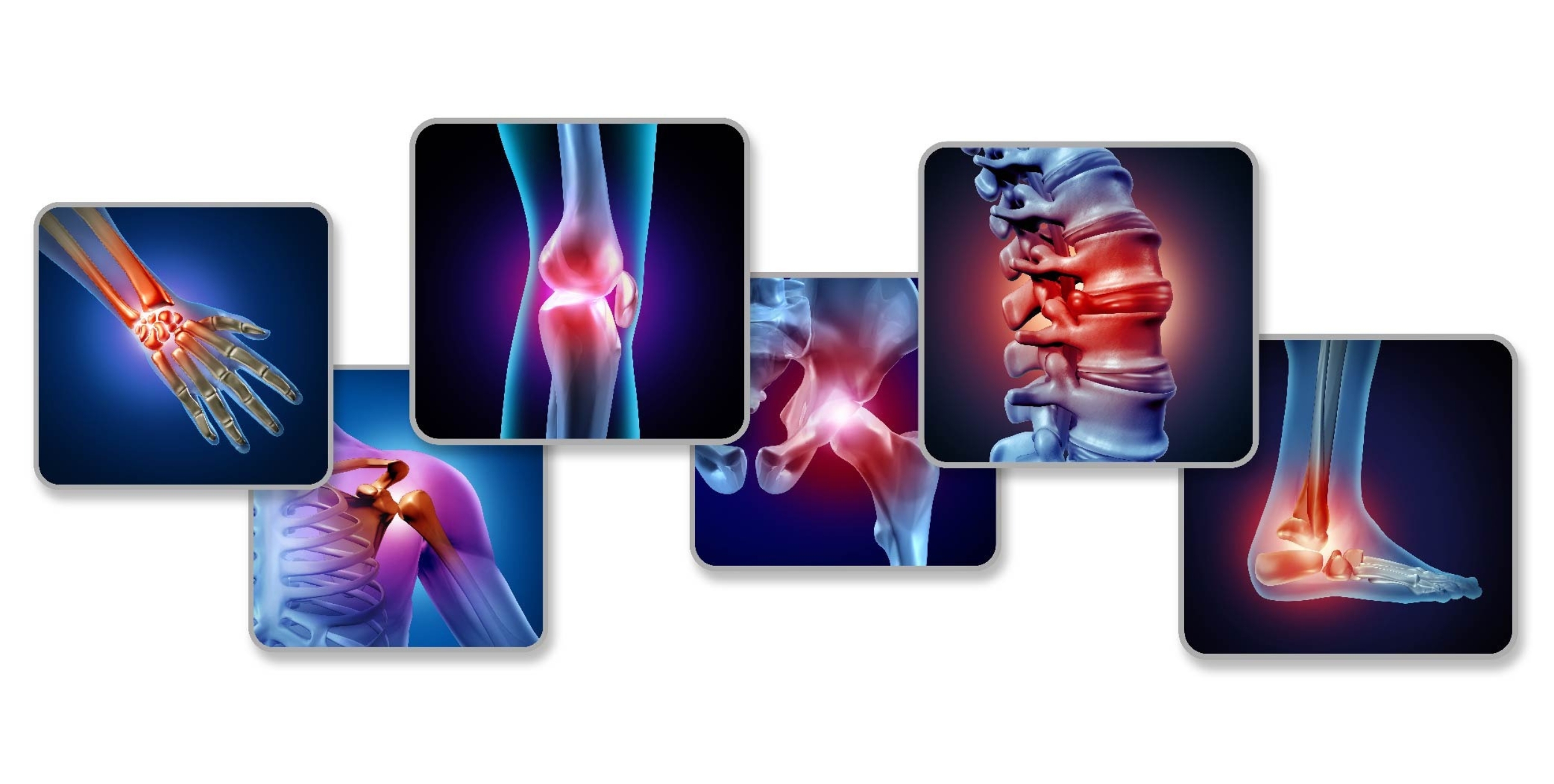 Desi Arthritis Website (11)