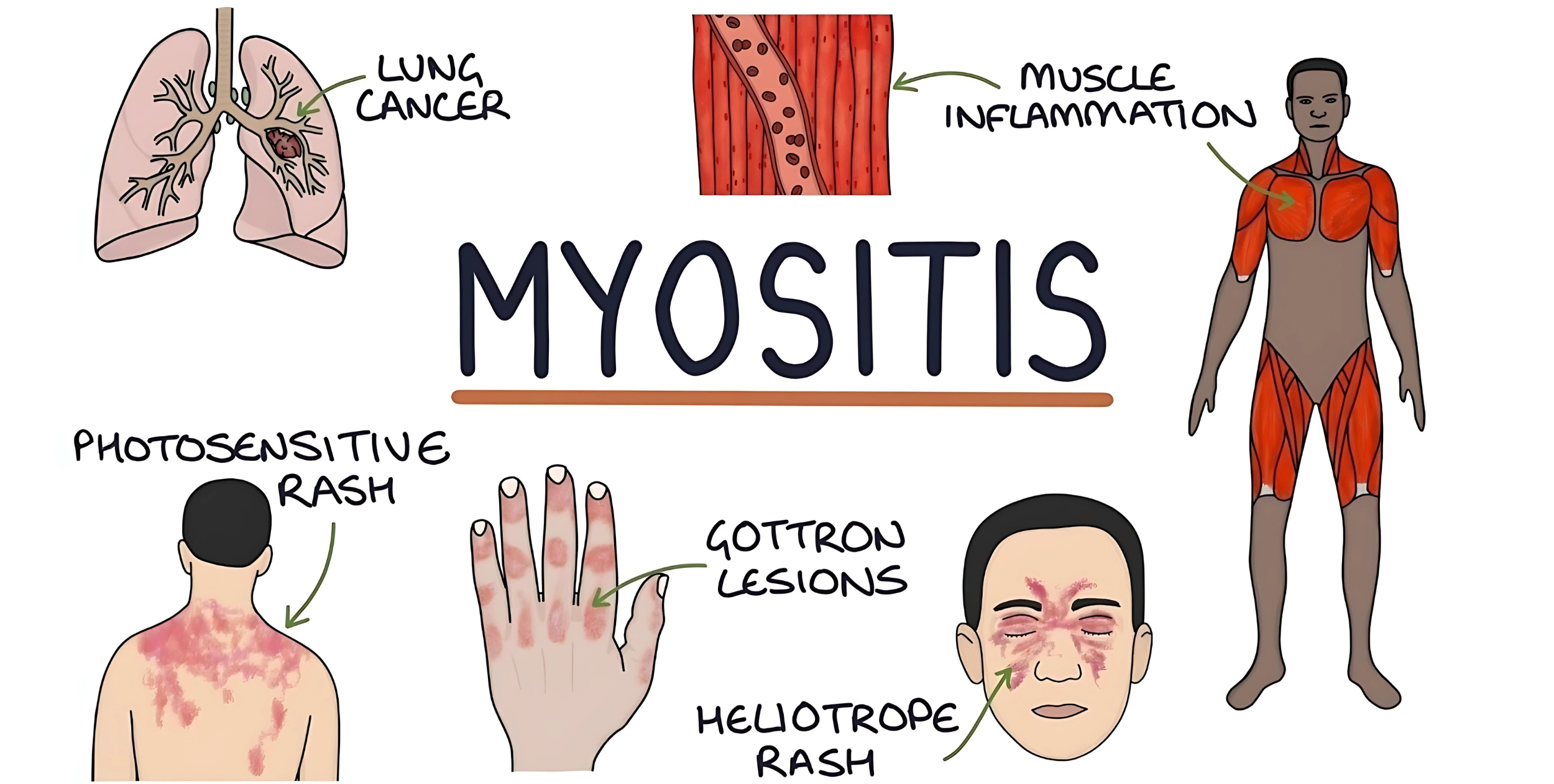 Desi Arthritis Website (12)