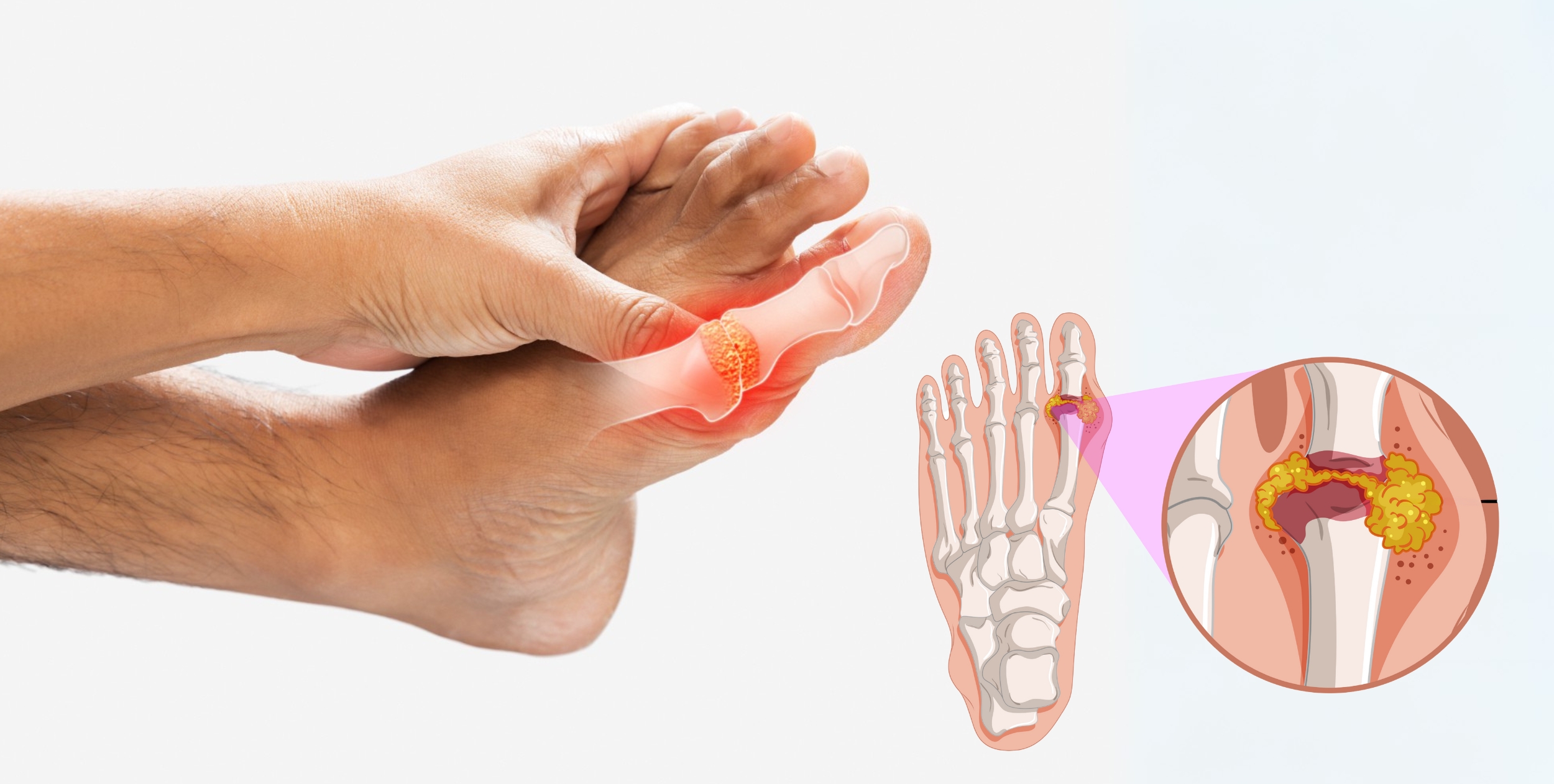 Desi Arthritis Website (3)