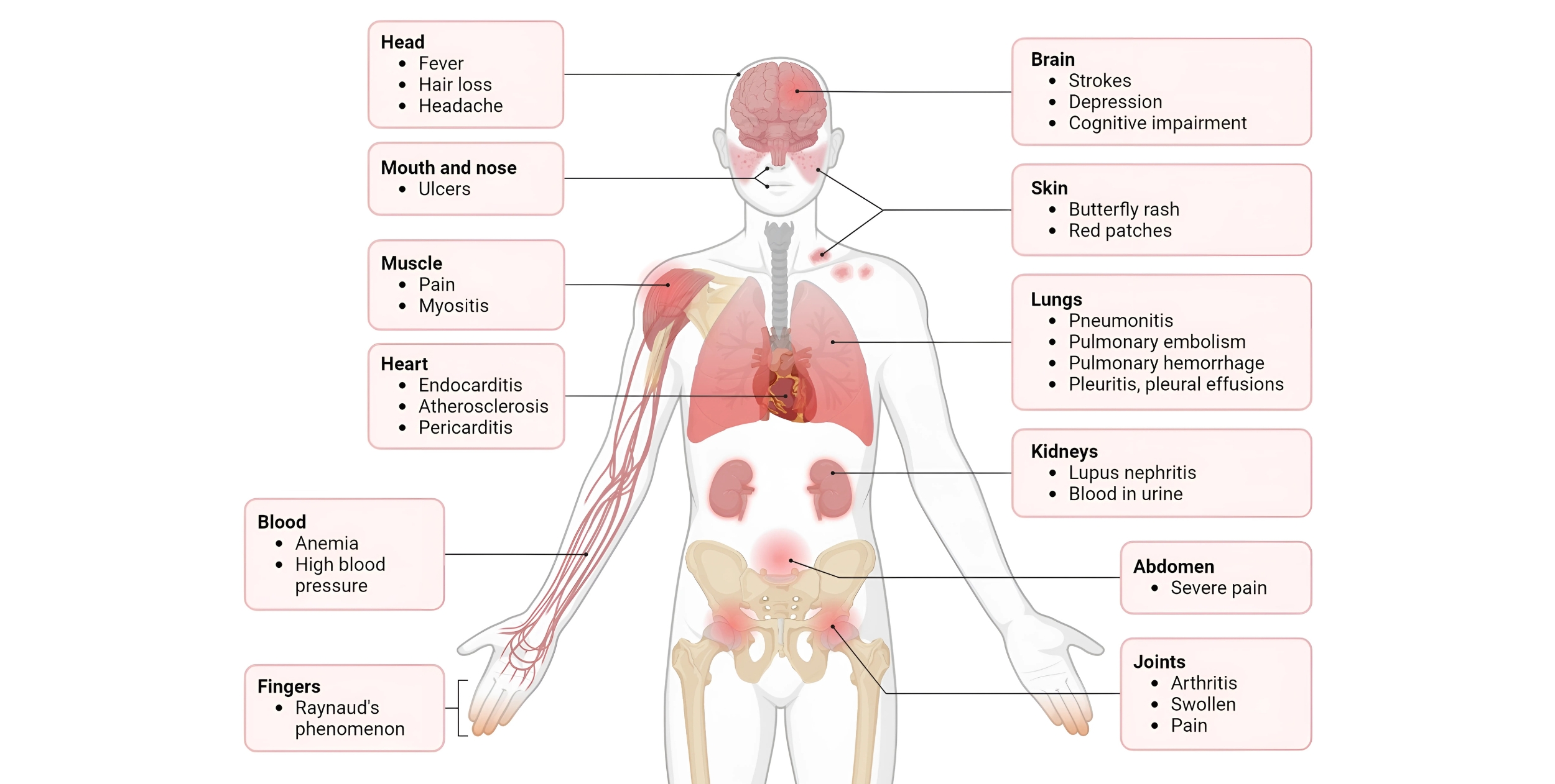 Desi Arthritis Website (6)