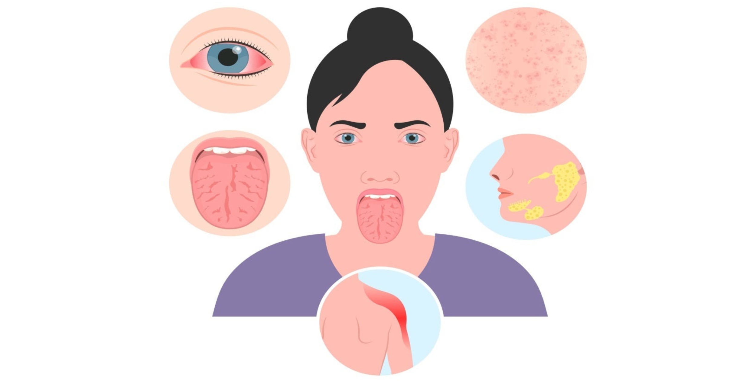 Desi Arthritis Website (8)