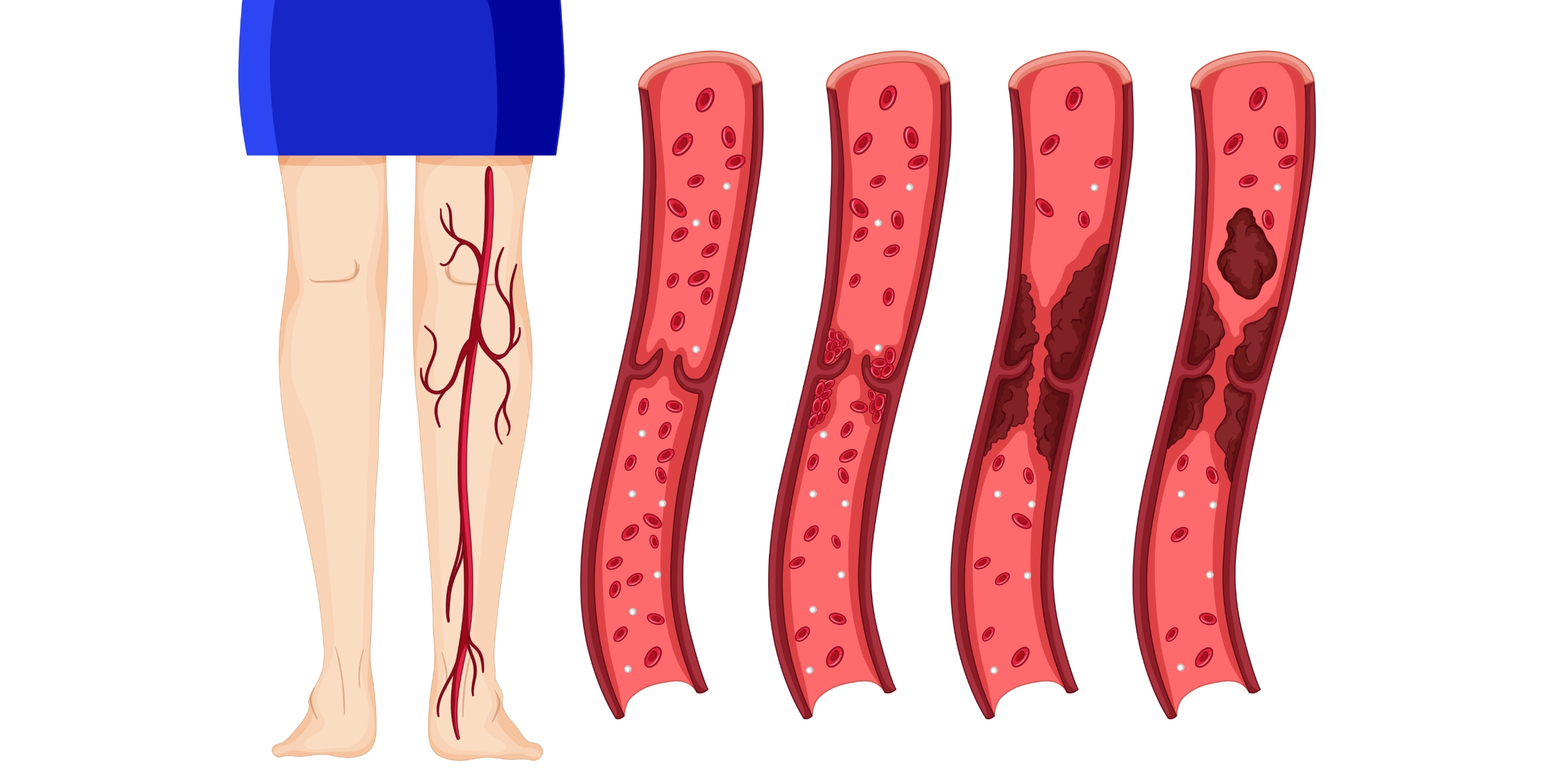 Desi Arthritis Website (9)